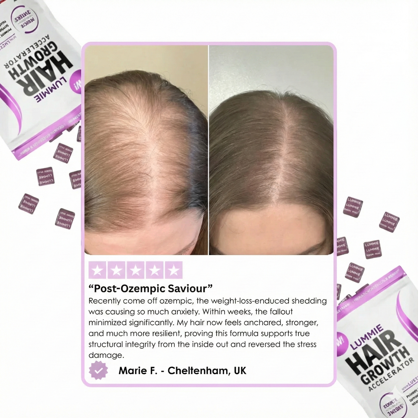 LUMMIE hair growth gummies